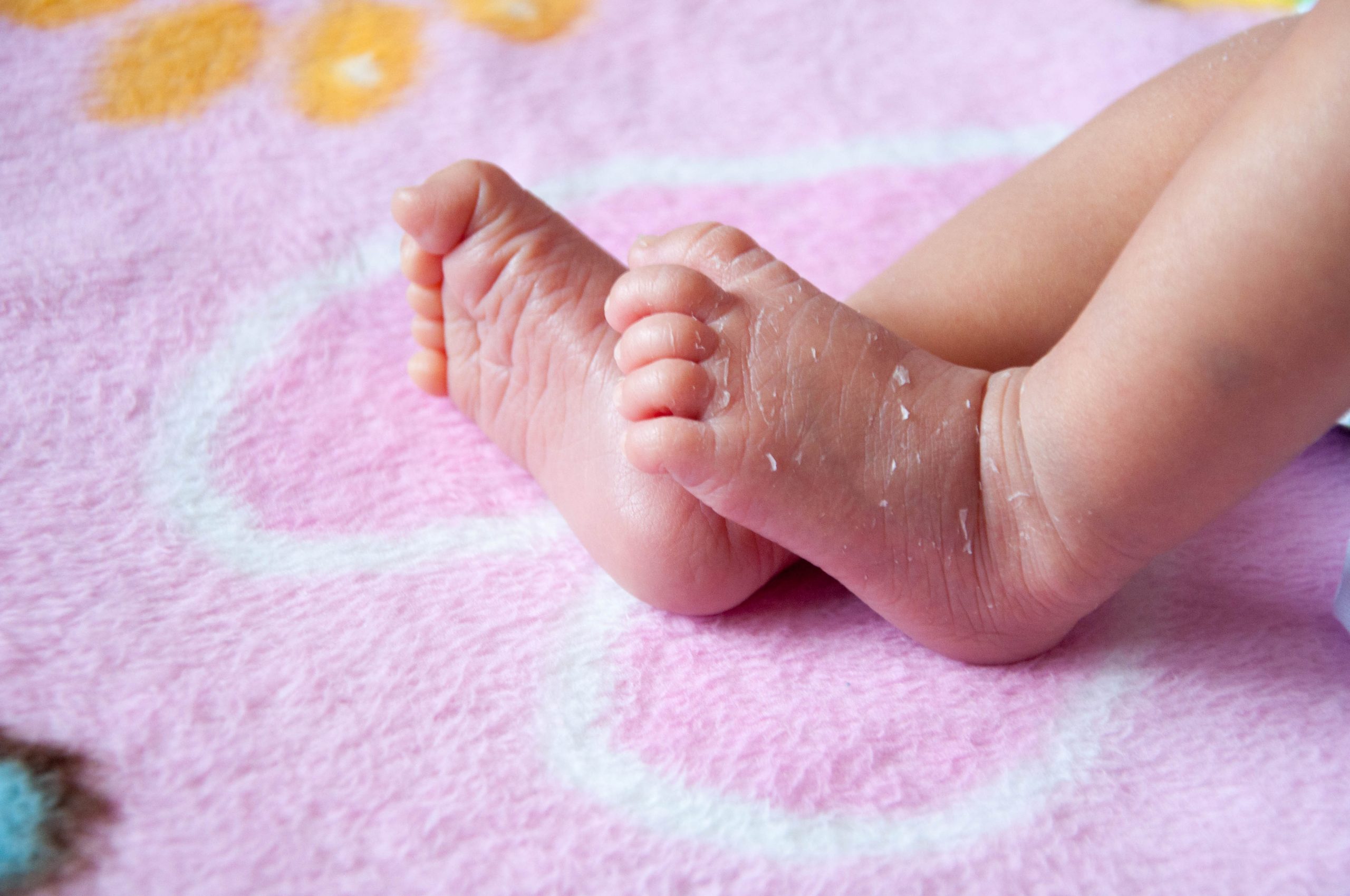 Почему у ребенка облезает кожа на пальцах ног